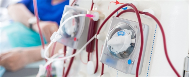 Hemodialysis machine with person in the background Hemodialysis machine with person in the background